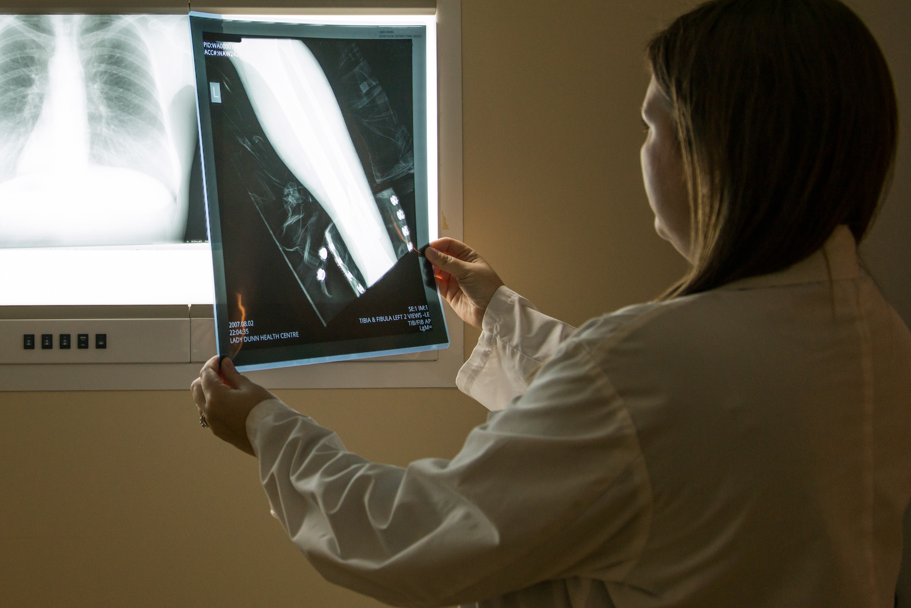 Voici une photo d'un employé qui tient des résultats d'un rayon-X.